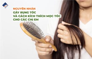 Nguyên nhân gây rụng tóc & cách kích thích mọc tóc cho các chị em