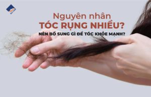 Nguyễn nhân tóc rụng nhiều, nên bổ sung gì để tóc khỏe mạnh