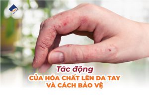 Tác động của hóa chất lên da tay và cách bảo vệ