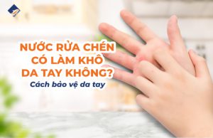 Nước Rửa Chén Có Làm Khô Da Tay Không? Cách Bảo Vệ Da Tay