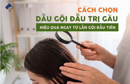 Cách chọn dầu gội đầu trị gàu hiệu quả ngay từ lần gội đầu tiên