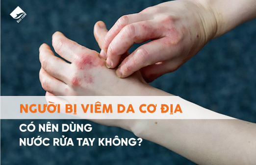 Người bị viêm da cơ địa có nên dùng nước rửa tay không?