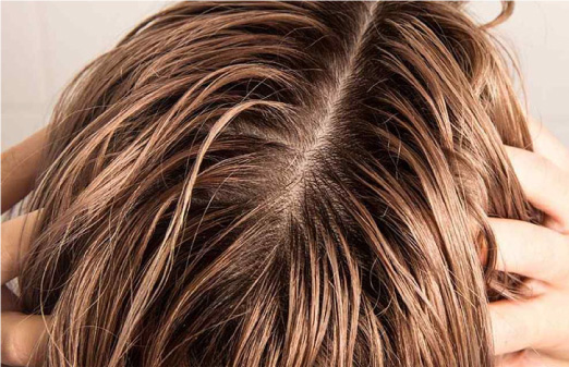Vì sao tóc bạn nhanh bết và bóng dầu