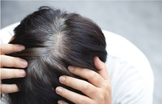 Hiểu đúng về tóc bạc