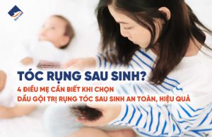 Tóc rụng sau sinh. 4 điều mẹ cần biết khi chọn dầu gội