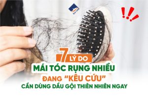 7 lí do mái tóc rụng nhiều đang kêu cứu cần dùng dầu gội thiên nhiên ngay