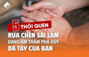 5 thói quen rửa chén sai lầm đang âm thầm phá hủy da tay của bạn