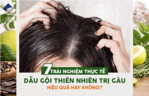 7 trải nghiệm thực tế dầu gội thiên nhiên trị gàu: hiệu quả hay không?