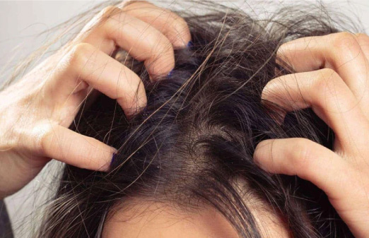 3. Trải nghiệm 2: Da đầu bớt ngứa, giảm kích ứng rõ rệt